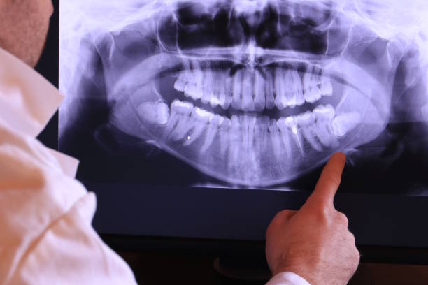 Best Emergency Care for Gum Disease in Fayetteville, WV